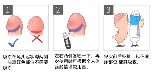 使用延时喷剂的注意事项